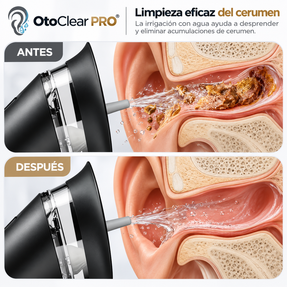 OtoClear PRO™ — Irrigador Eléctrico para Oídos | Limpieza Avanzada de Cerumen